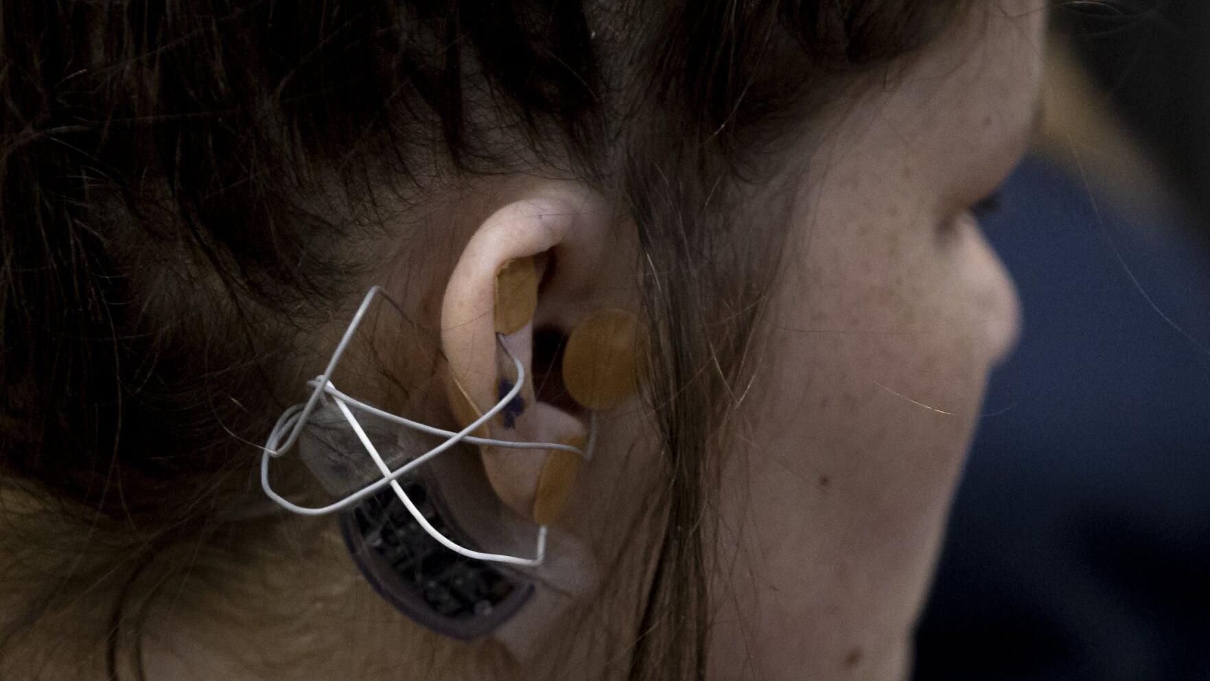 Electric shock for withdrawal? Virginia county takes chance on a new device for addiction